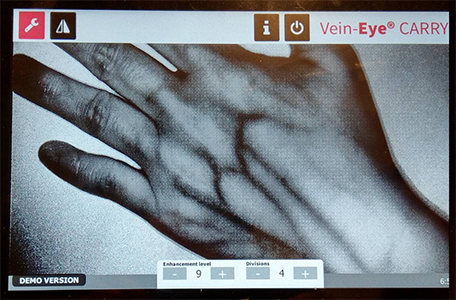 The medical Vein Finder App needs the high power processor to get the best vein image for vein access and venipuncture procedure